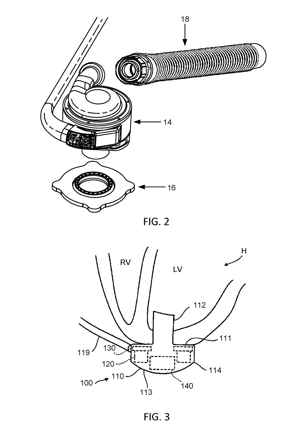 Methods for LVAD operation during communication losses