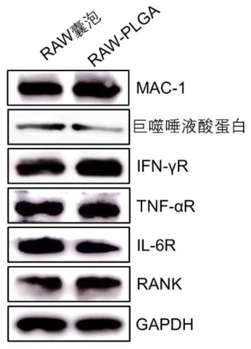 Cell membrane coated nano bait for removing RANKL, preparation and application thereof