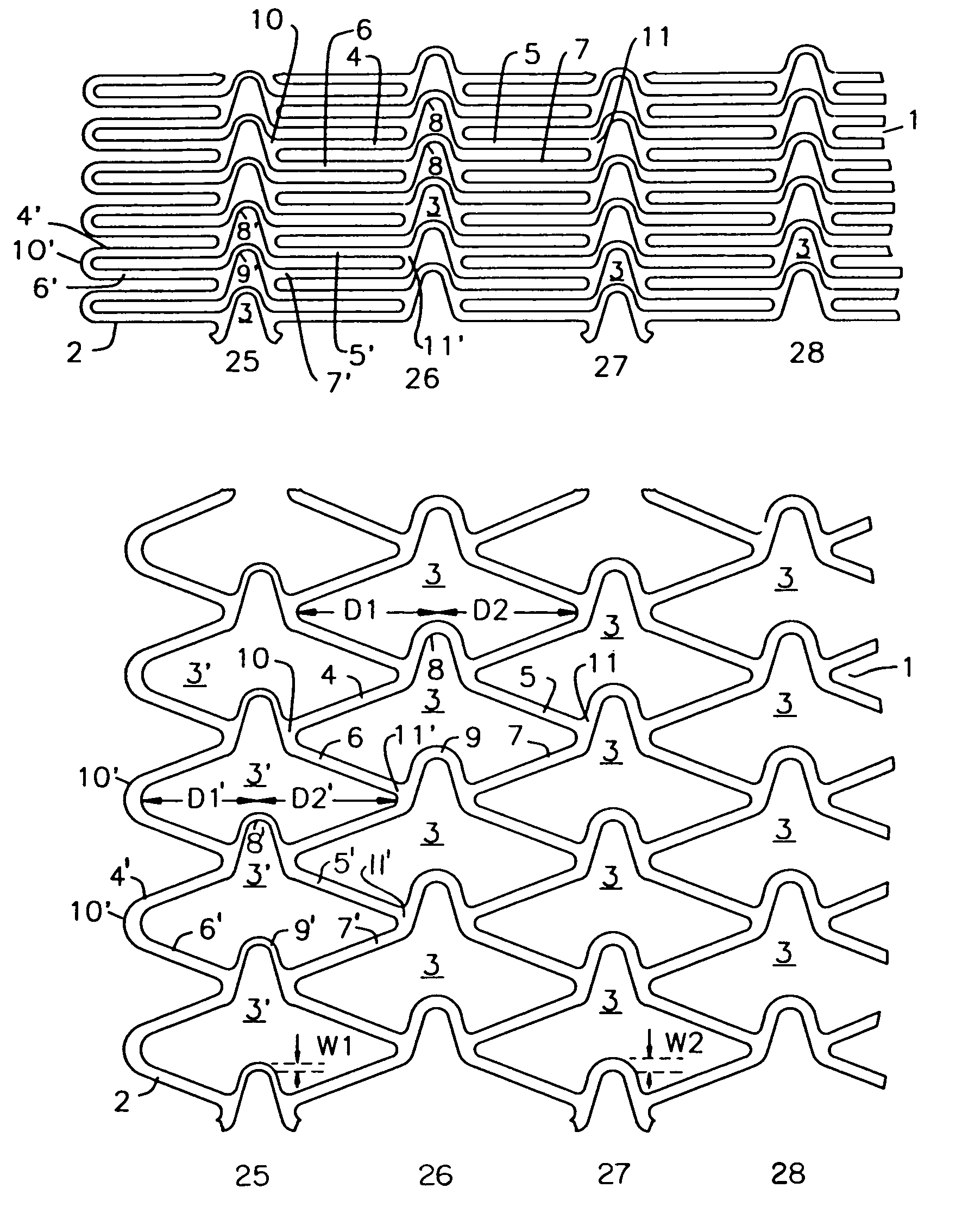 Stent with variable features to optimize support and method of making such stent