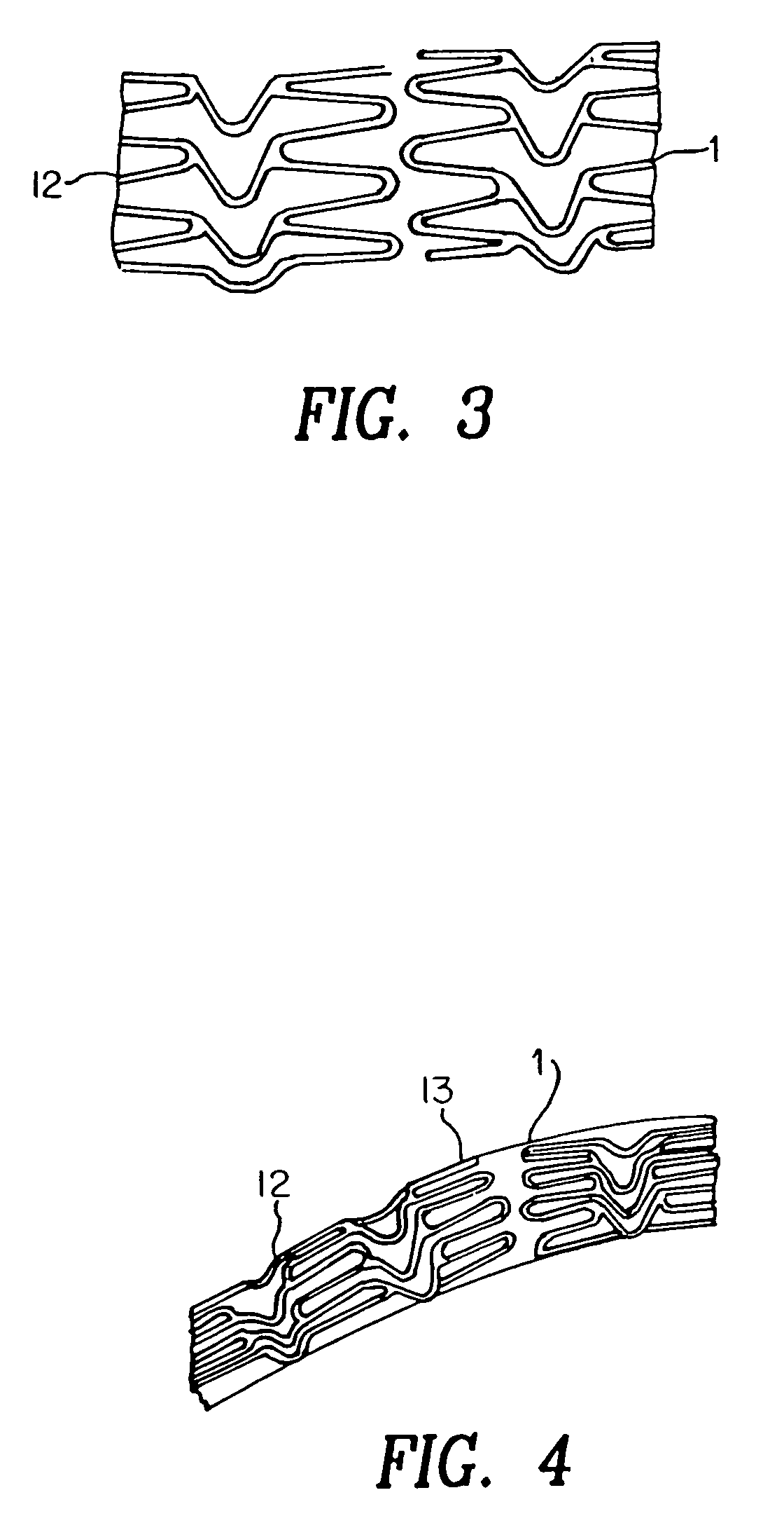 Stent with variable features to optimize support and method of making such stent