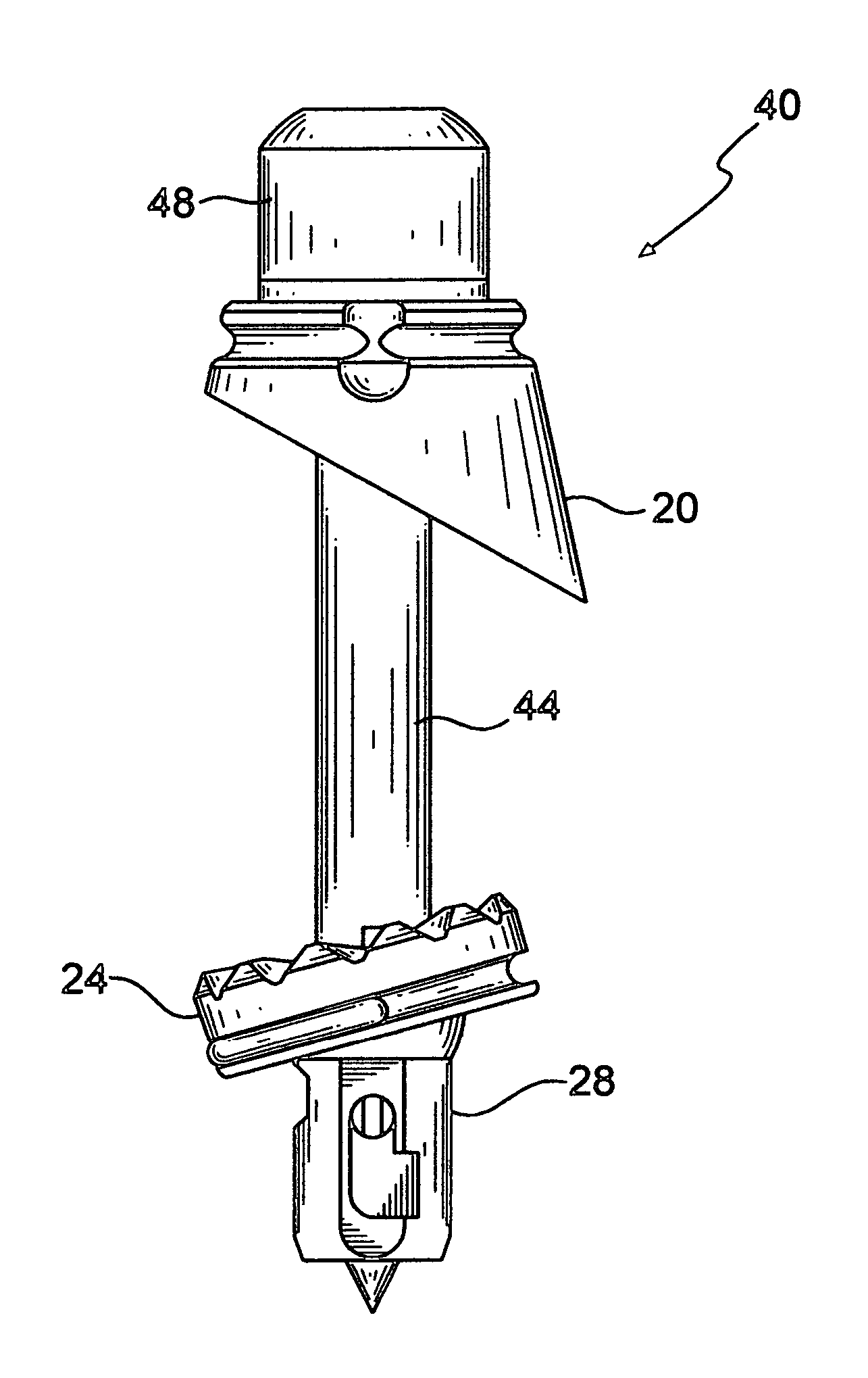 Bone fixation implant system and method