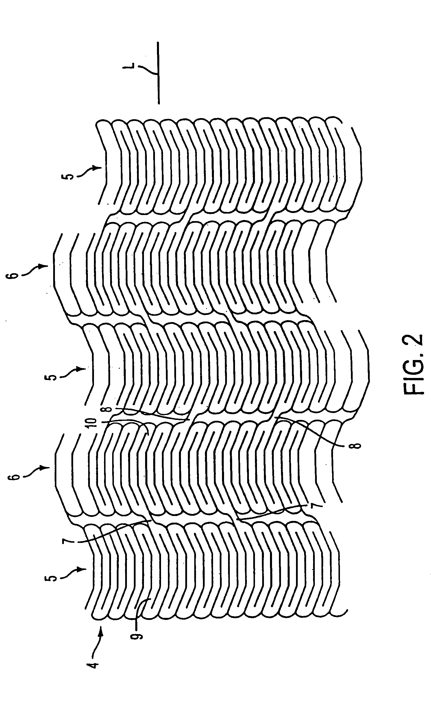 Methods and apparatus for a stent having an expandable web structure and delivery system