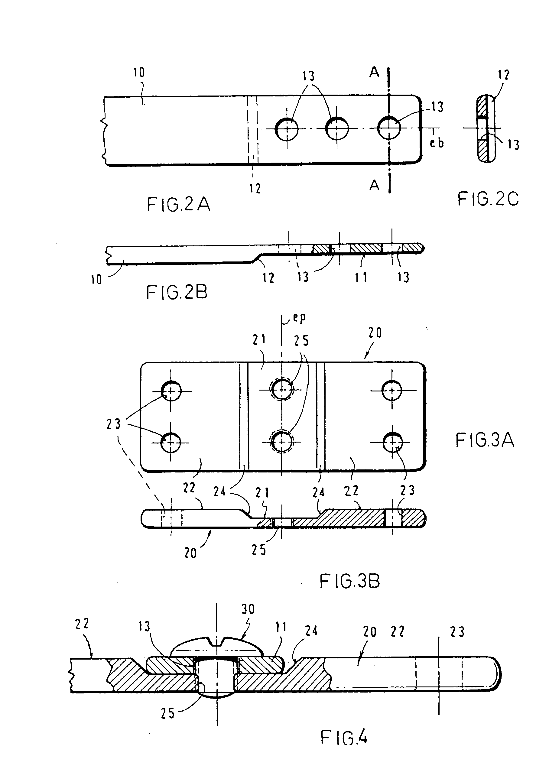 Apparatus for the correction of chest wall deformities such as pectus carinatum and method of using the same