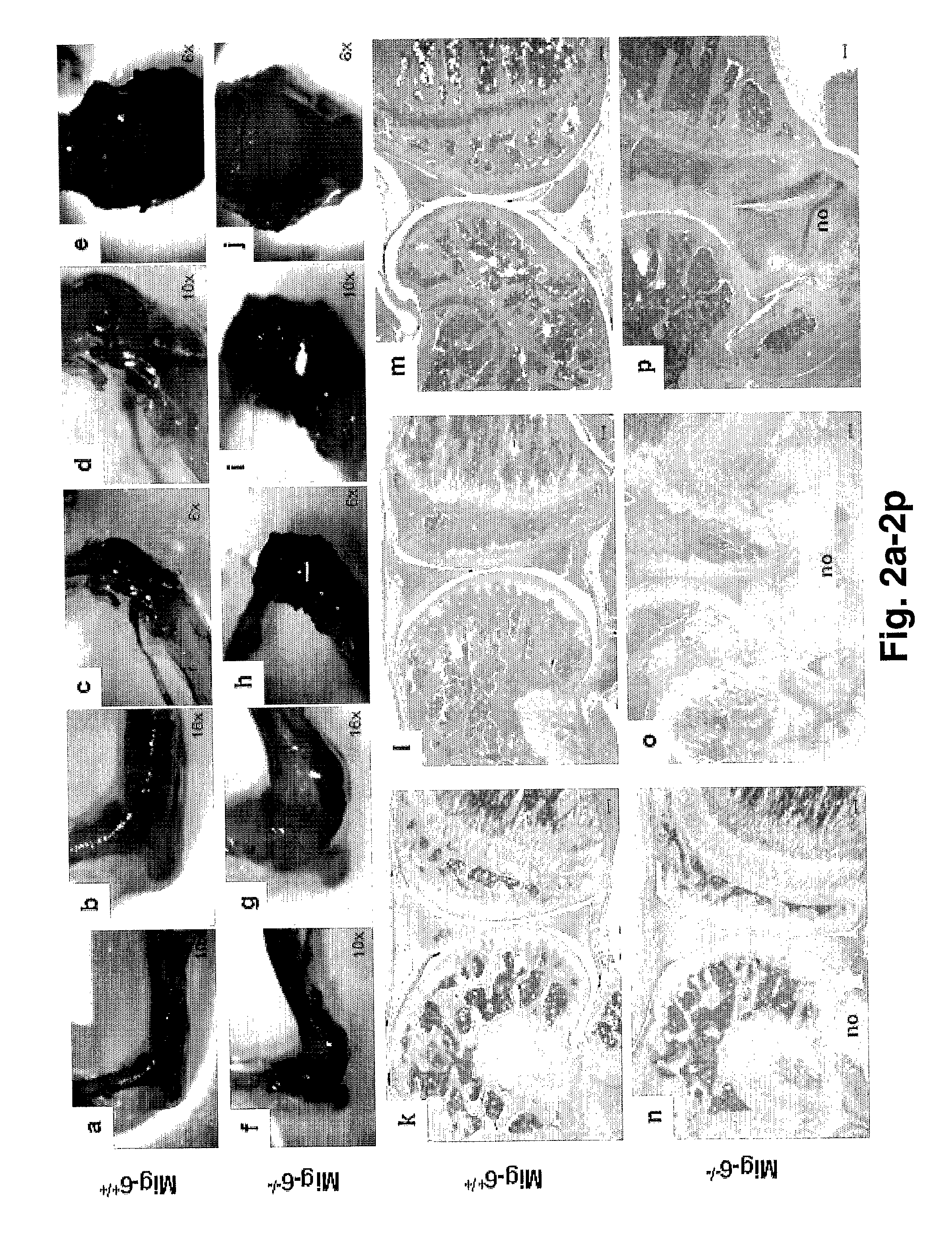 Mig-6 knockout mice and elucidation of association of Mig-6 with early onset degenerative joint disease and role as a tumor suppressor