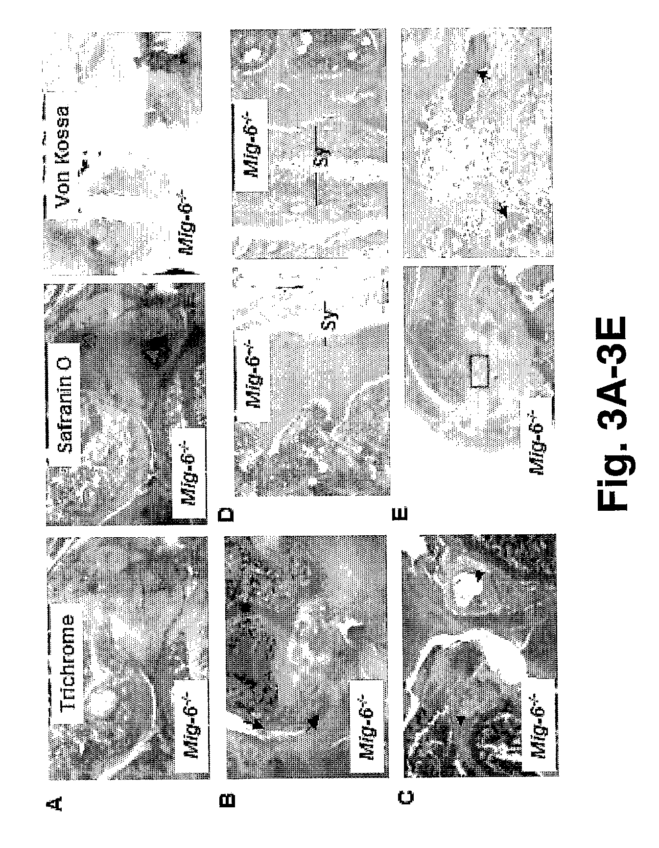 Mig-6 knockout mice and elucidation of association of Mig-6 with early onset degenerative joint disease and role as a tumor suppressor