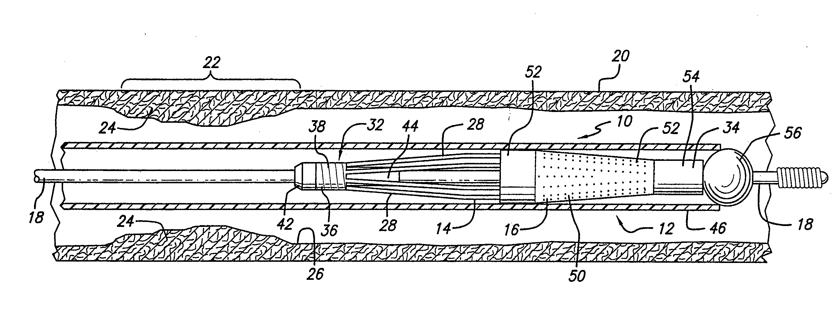 Embolic protection devices