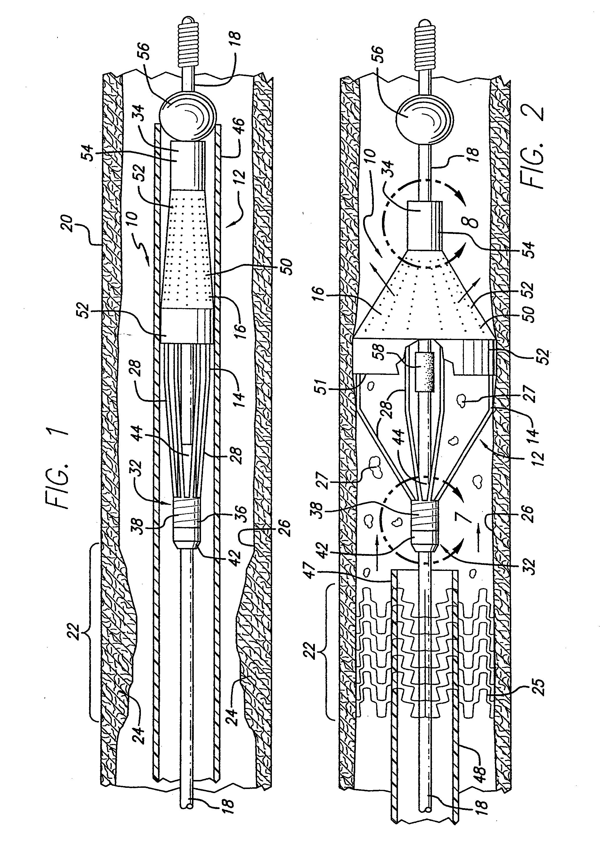 Embolic protection devices