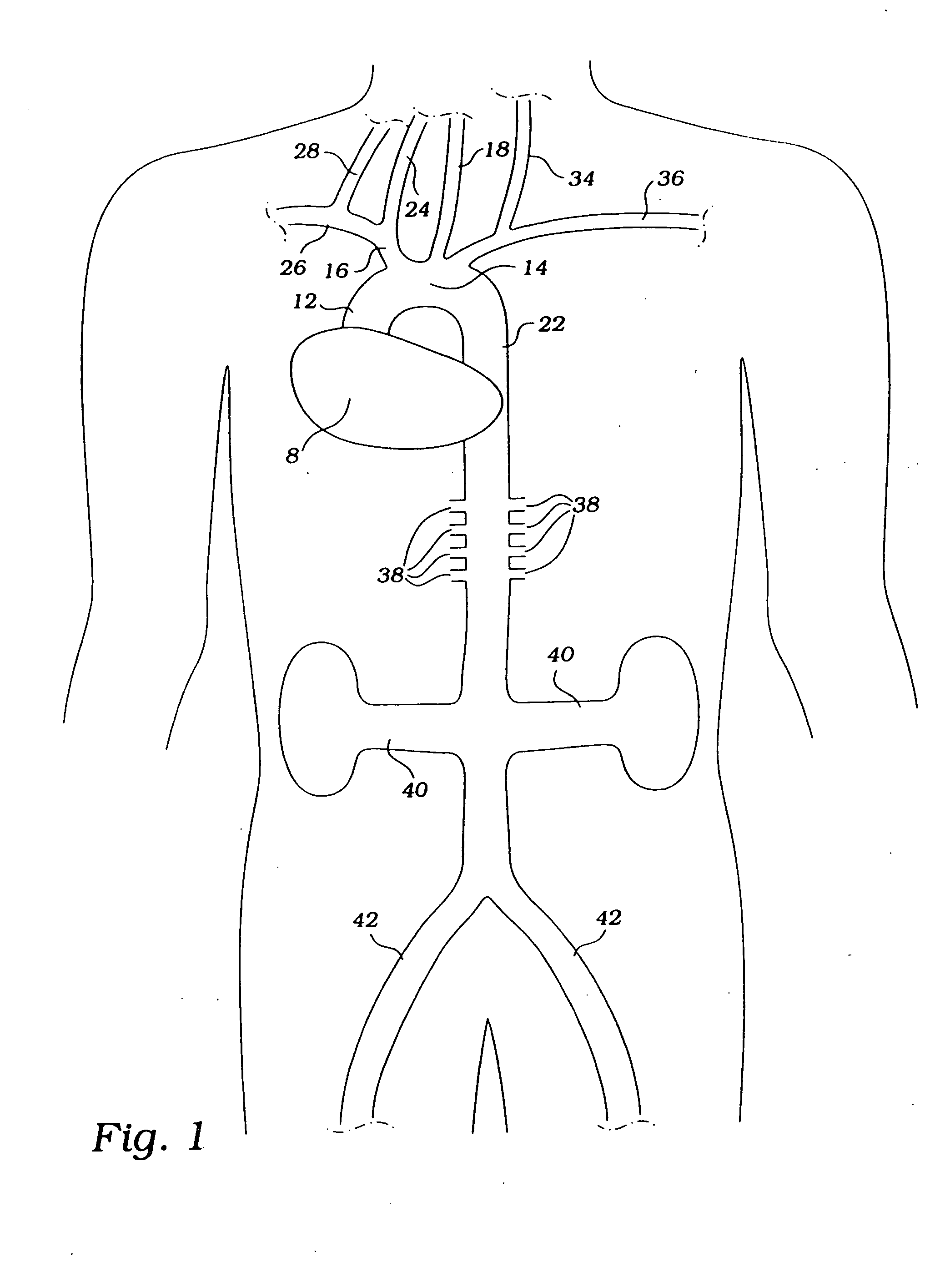 Cerebral perfusion augmentation