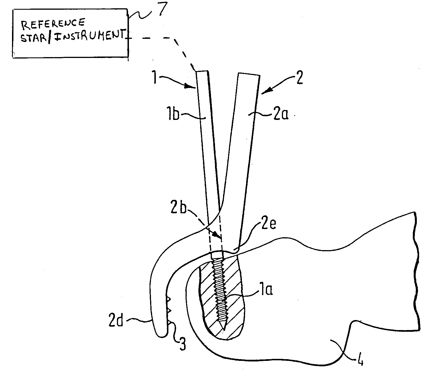 Device for fixing a reference element