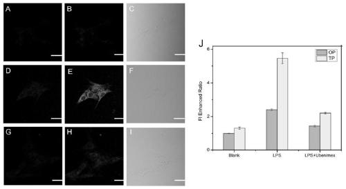 Two-photon fluorescent probe for detecting activity of pneumonia marker and synthesis method