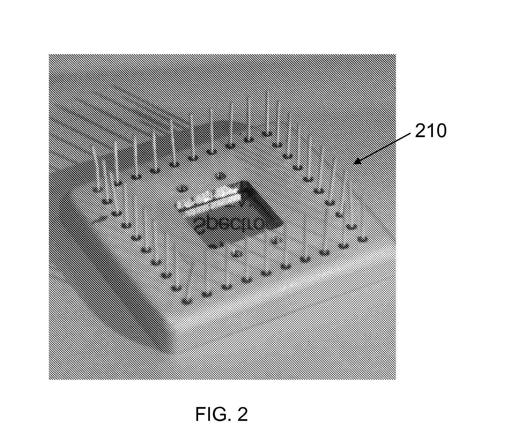 UV imaging for intraoperative tumor delineation