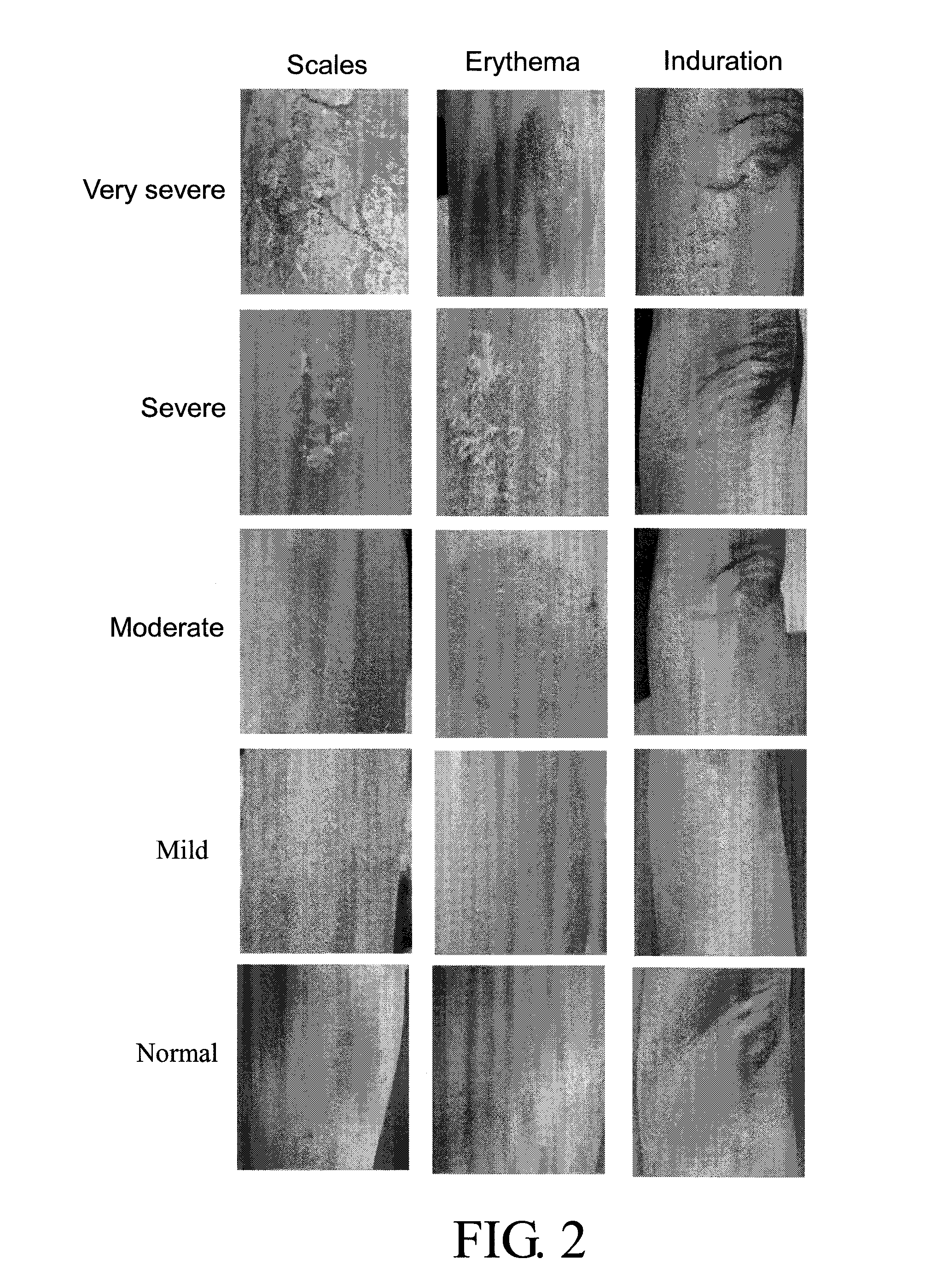 Oil-extracted product of indigo naturalis, and preparation process and uses thereof