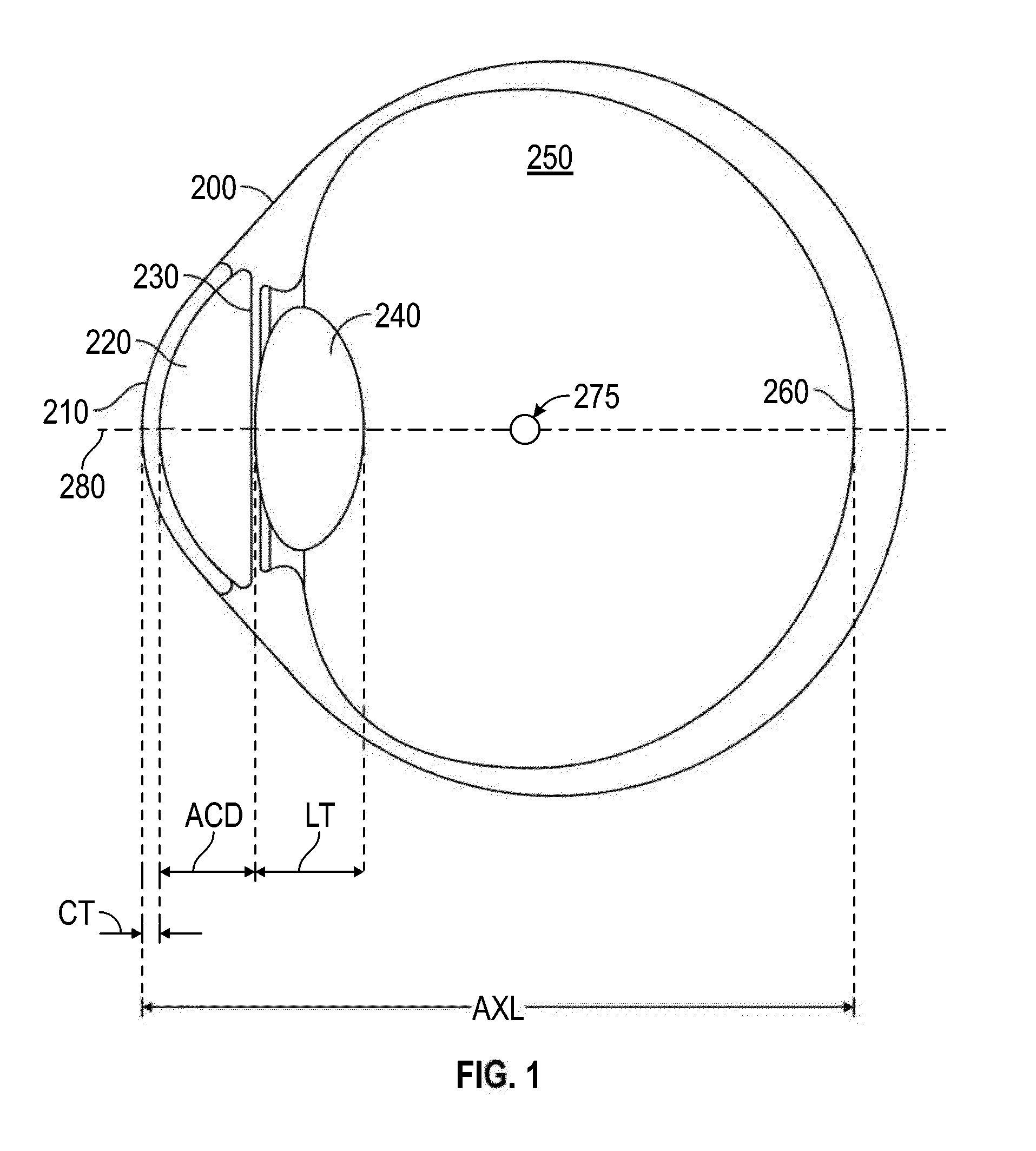 Enhanced toric lens that improves overall vision where there is a local loss of retinal function