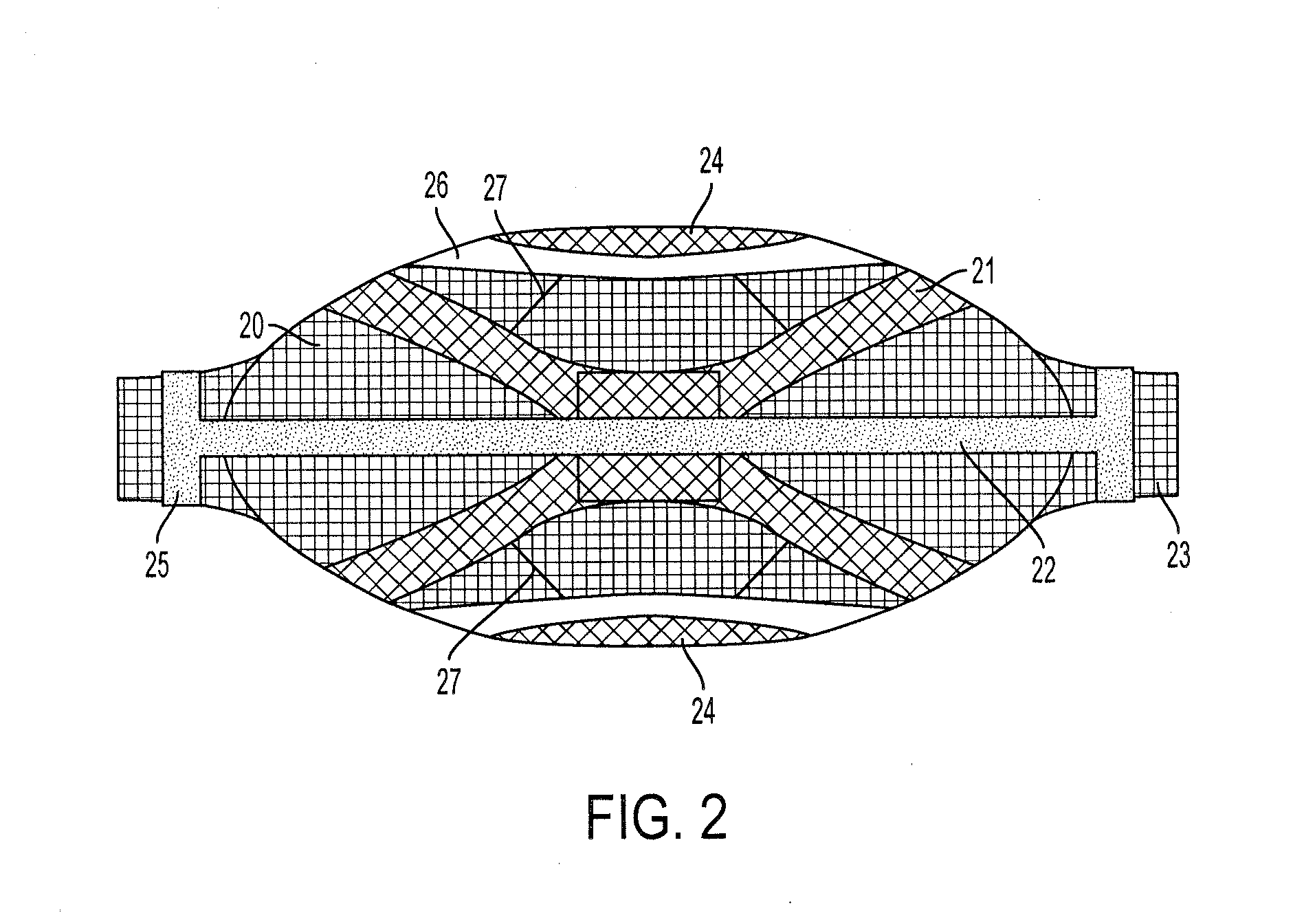 Active multicompartmental pressure redistribution system