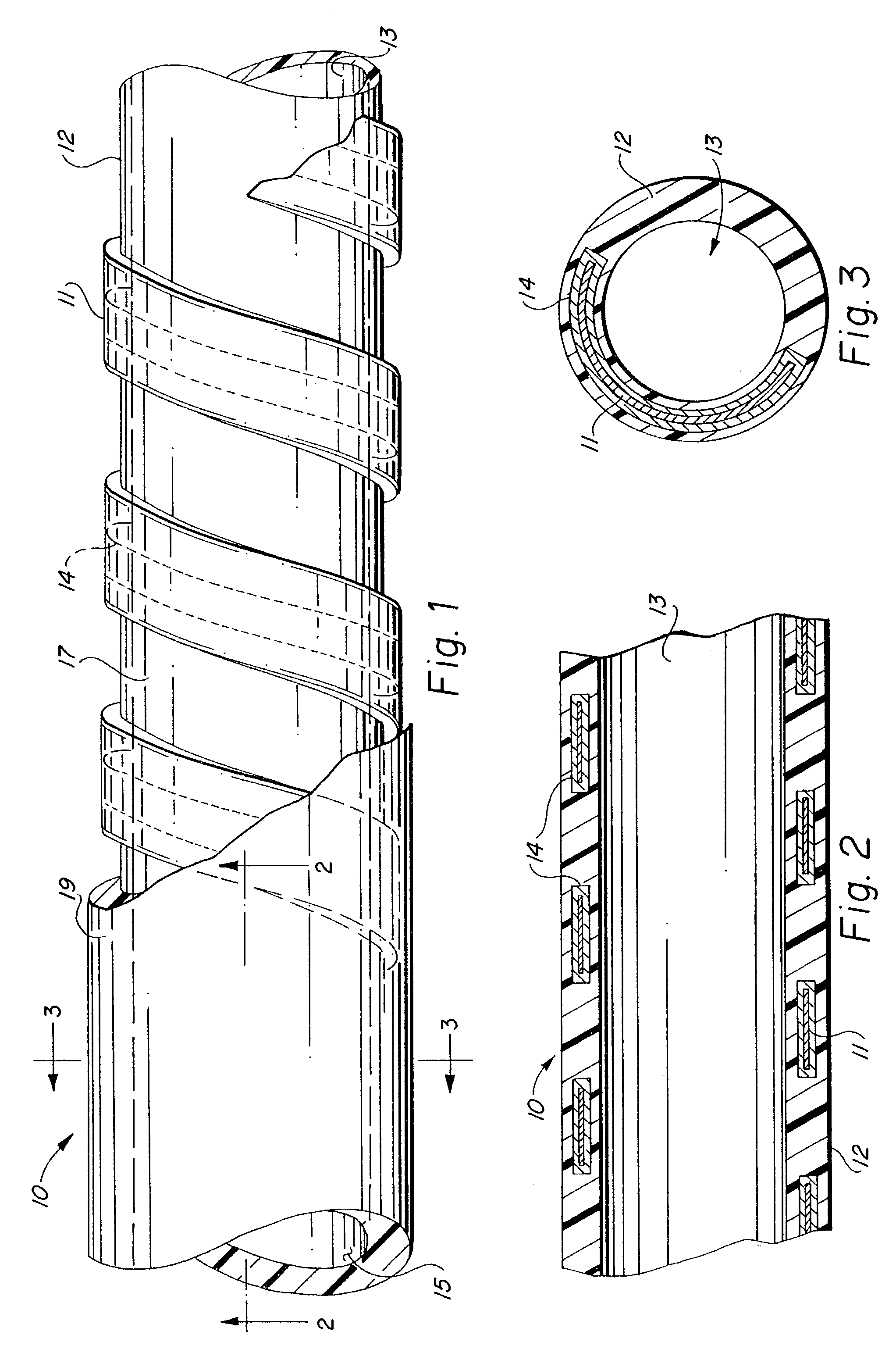 Methods for making a supported graft