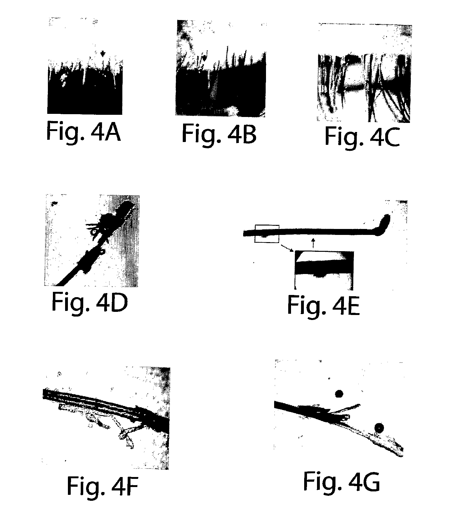 Method for Treating Ocular Demodex