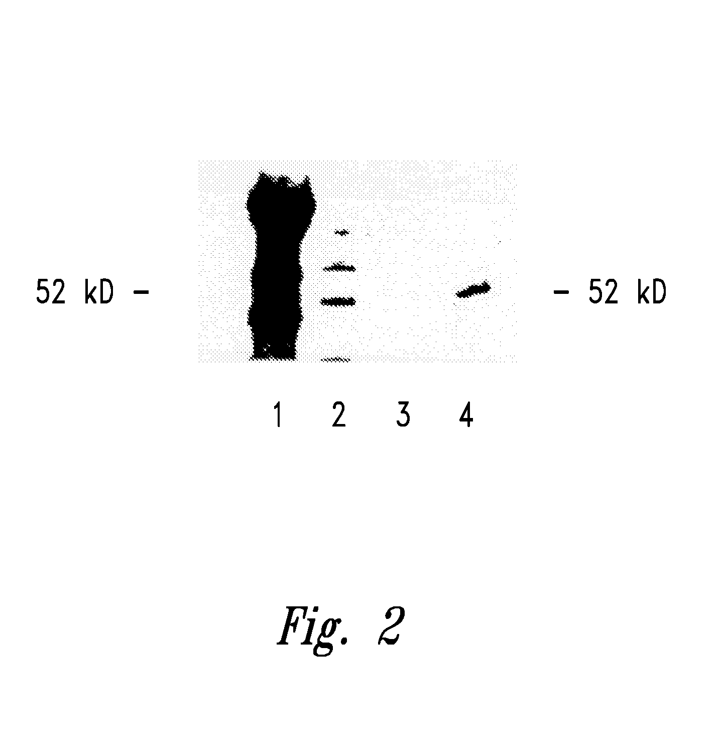 Compositions and method for WT1 specific immunotherapy