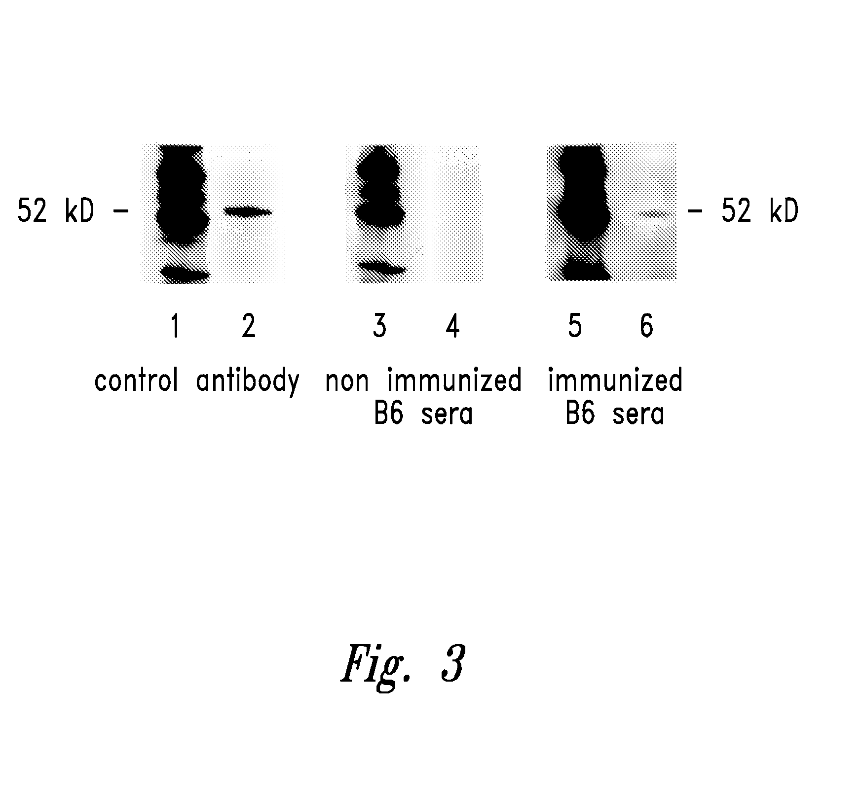 Compositions and method for WT1 specific immunotherapy