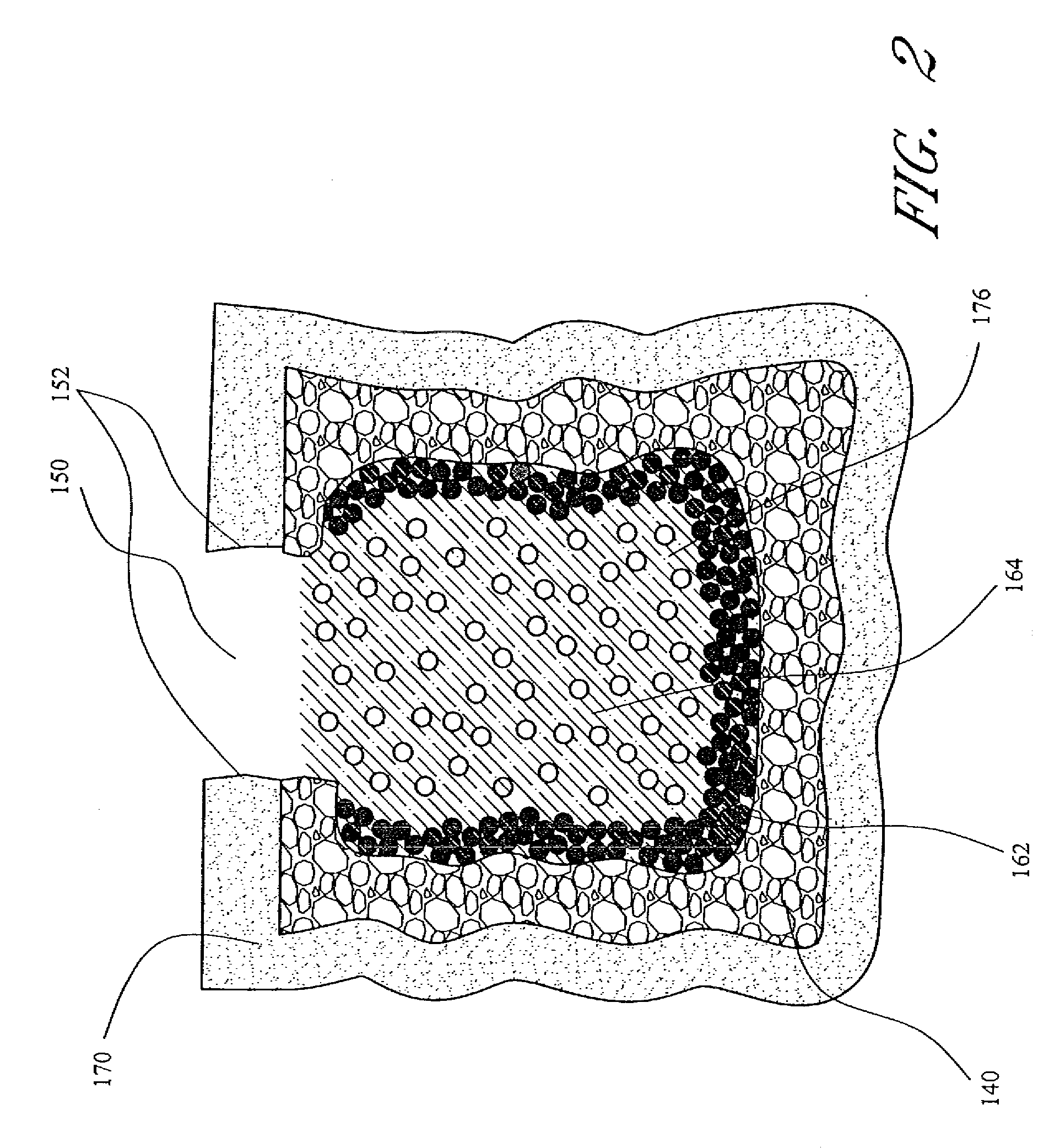 Vertebroplasty methods with optimized shear strength and crack propagation resistance