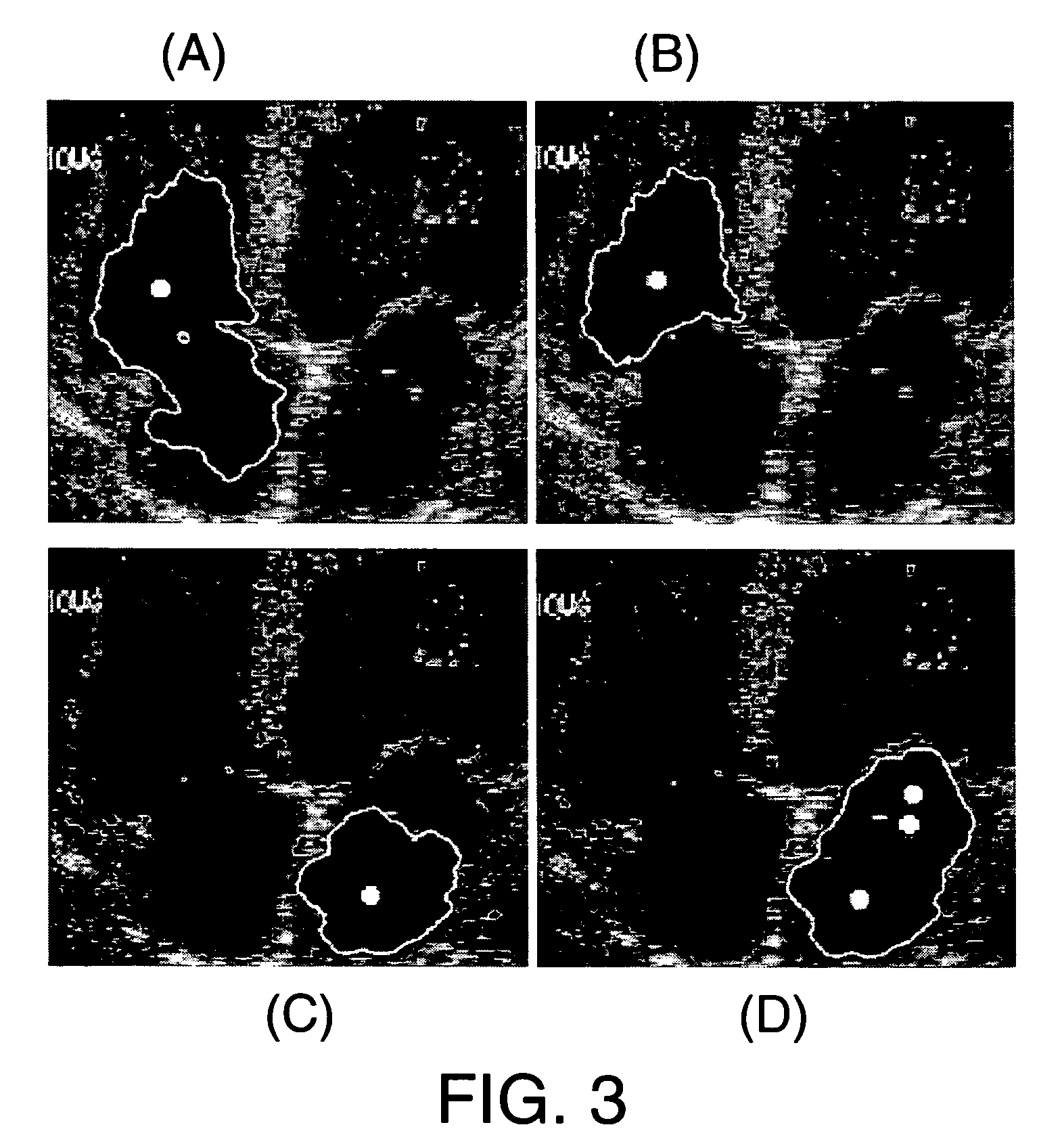 Method and system for interactive image segmentation