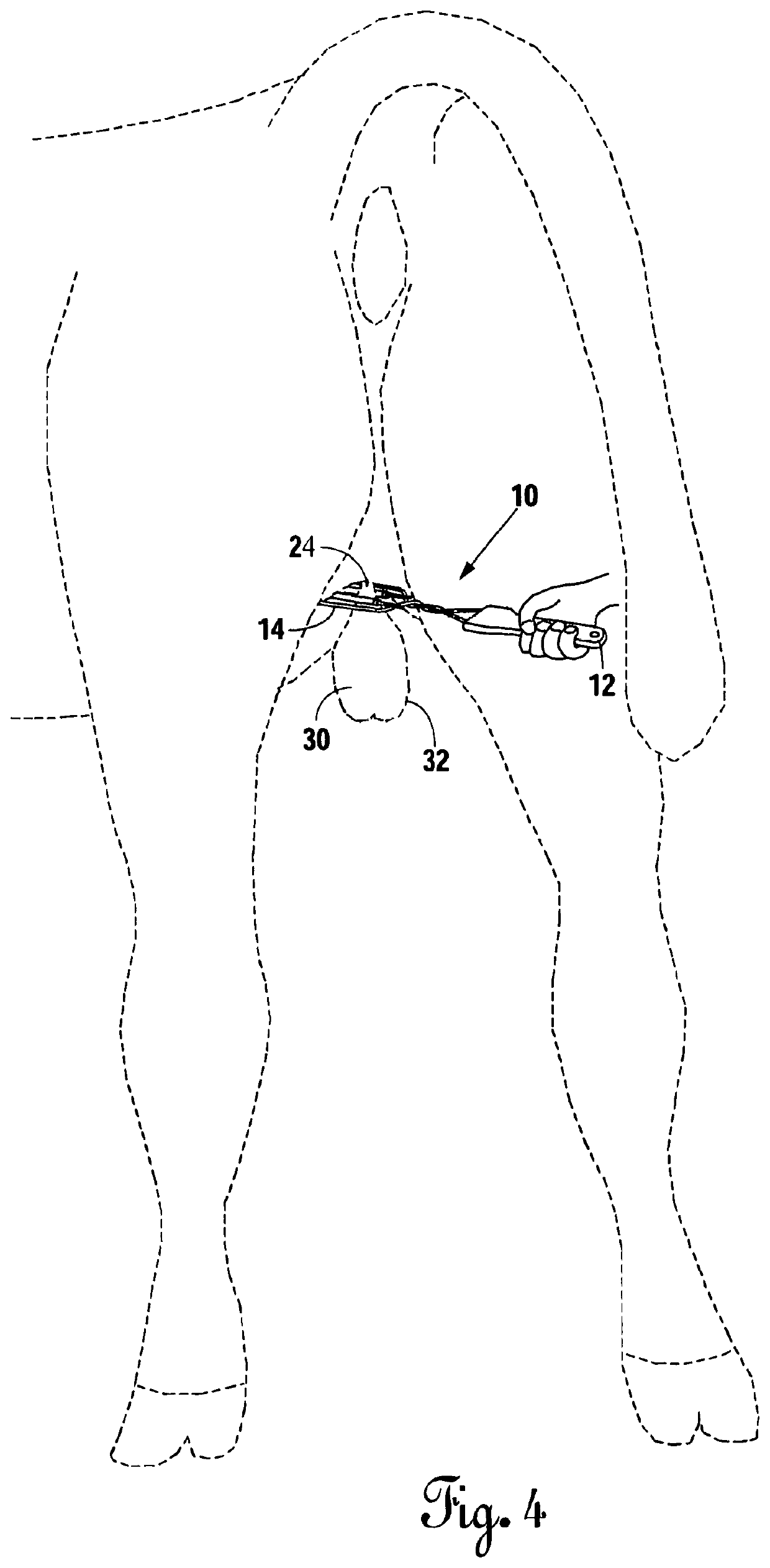 Device for Mitigating the Ascension of Testicles During Castration of Livestock