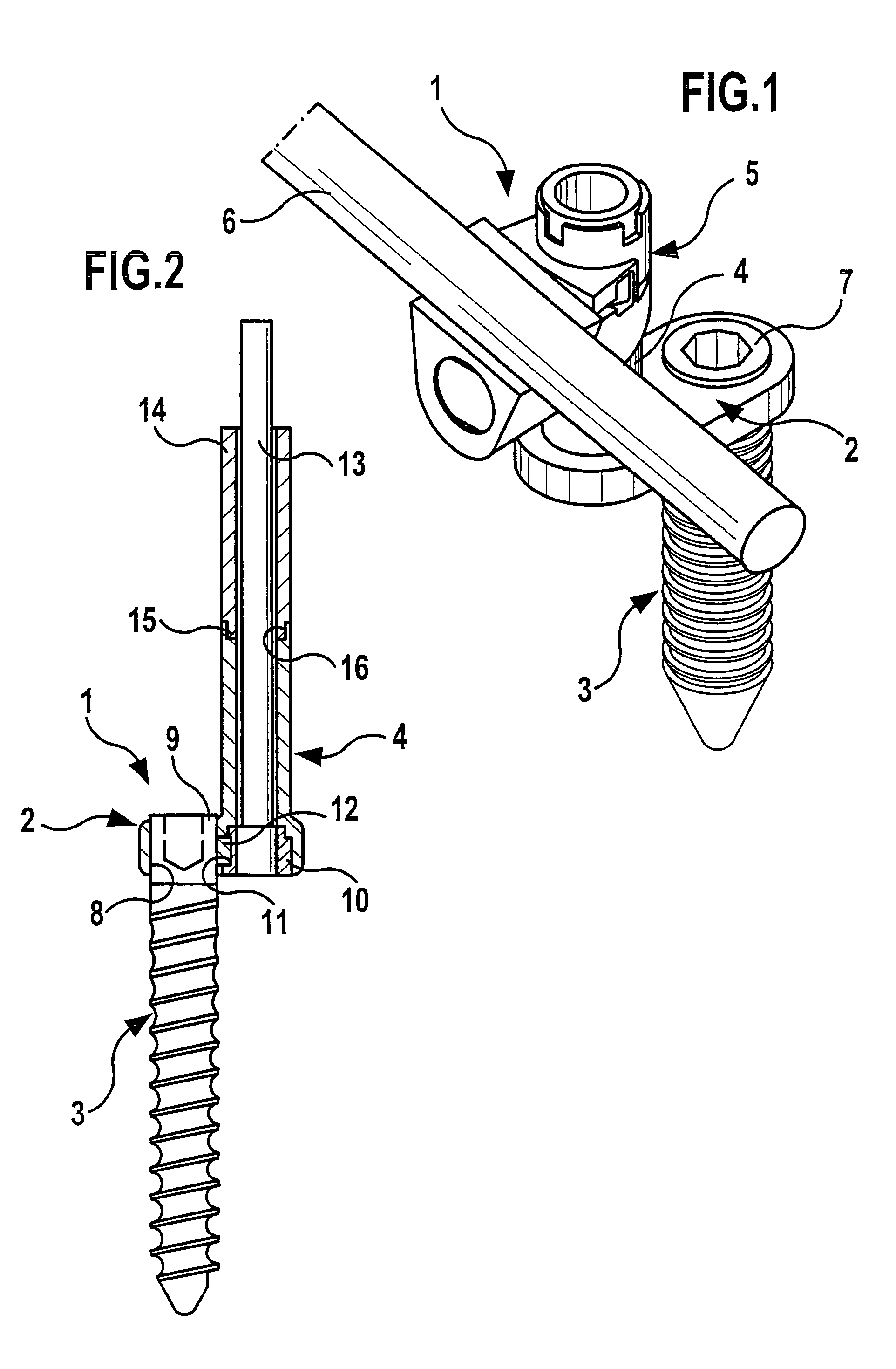 Offset orthopedic fixation device with locking mechanism