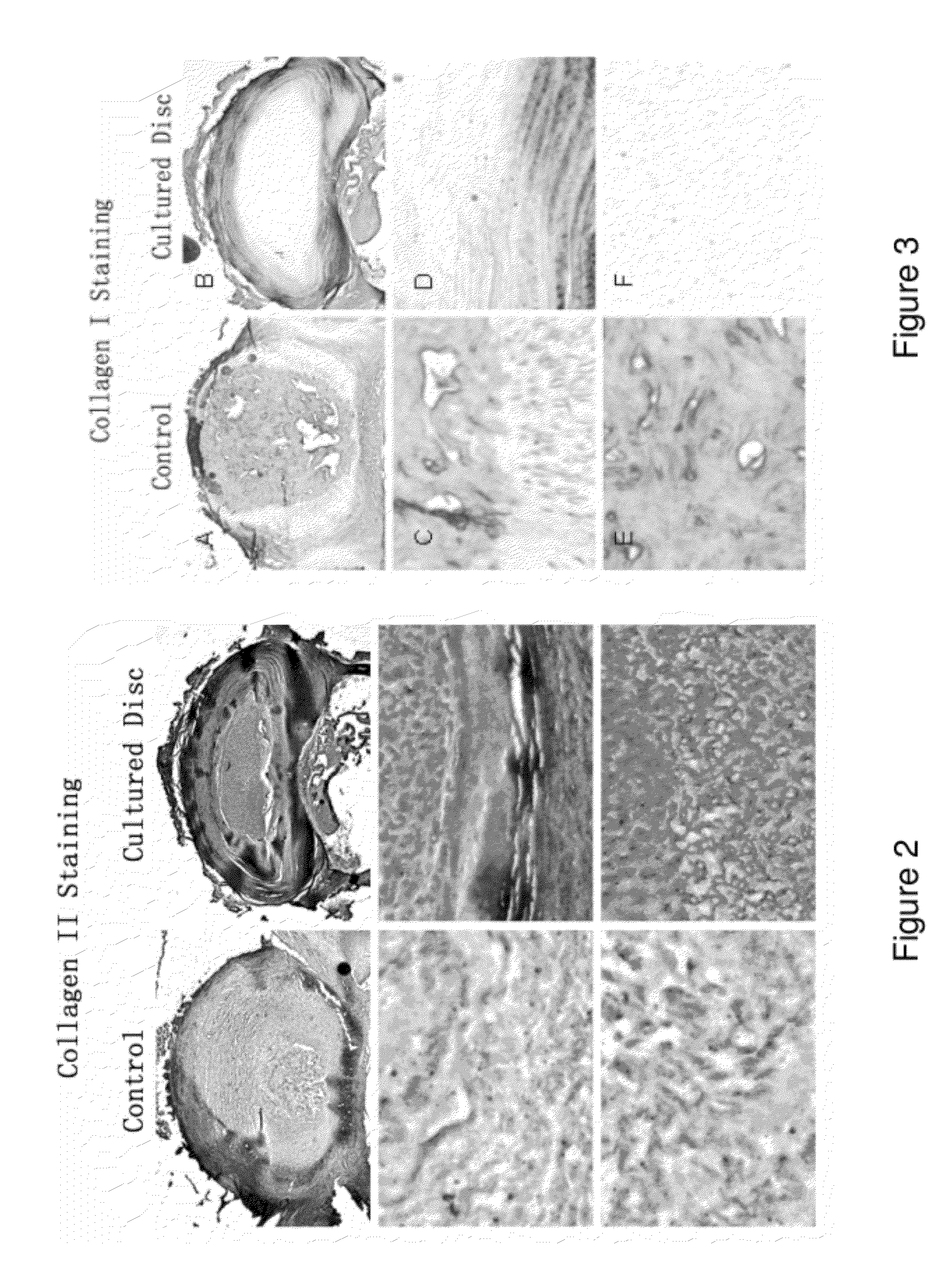 Compositions of adult disc stem cells and methods for the treatment of degenerative disc disease