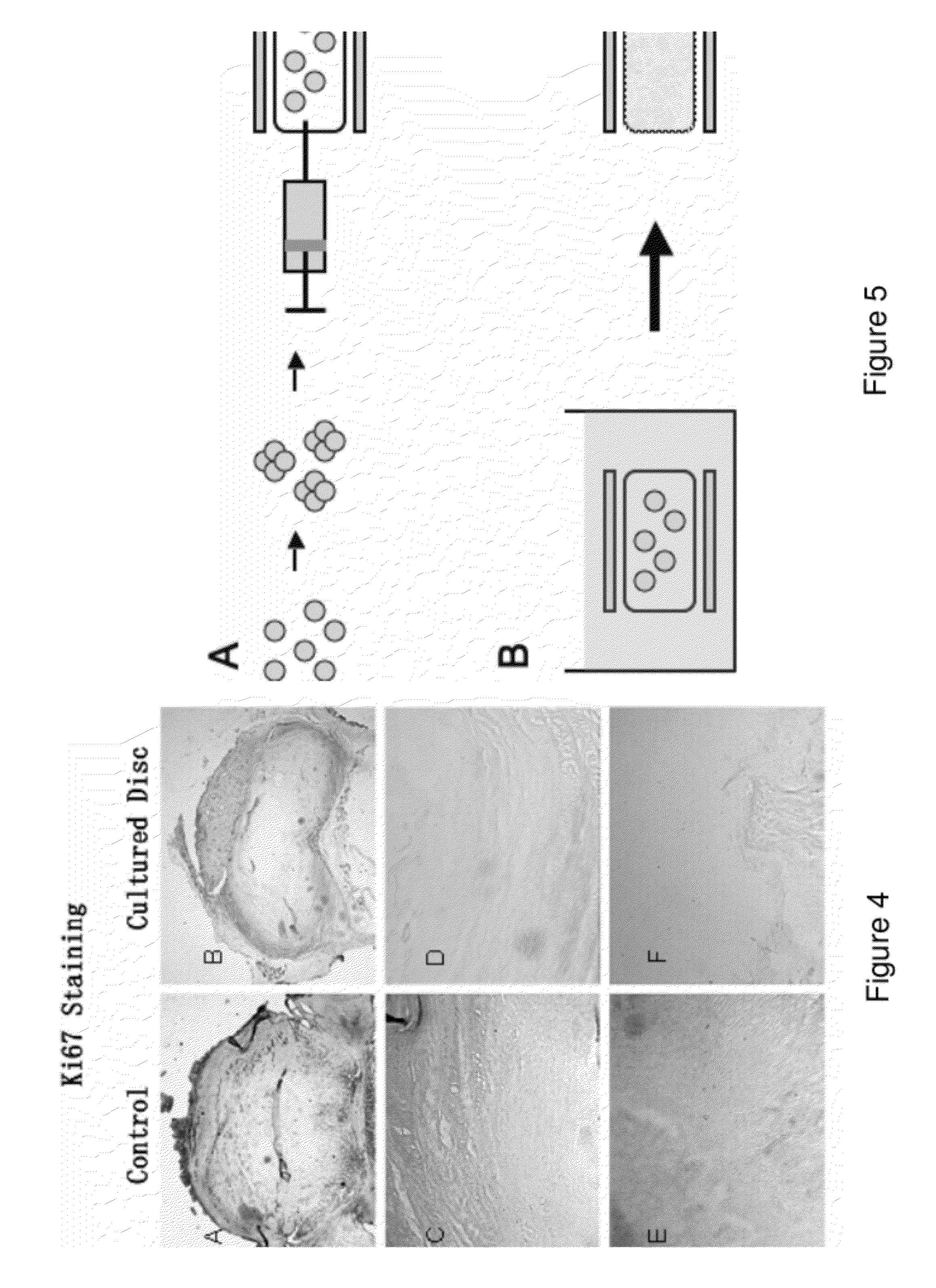 Compositions of adult disc stem cells and methods for the treatment of degenerative disc disease