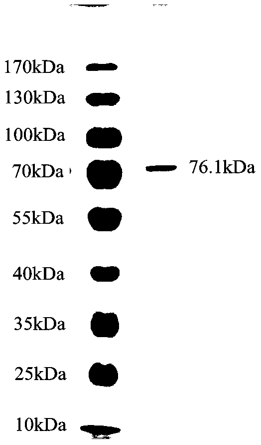 A bacterium and the chondroitinsulfate enzyme abc it produces