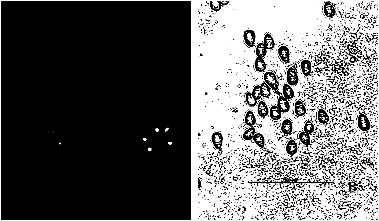 Recombinant arthrobotrys oligospora of Aozl gene dual promoters and preparation method of recombinant arthrobotrys oligospora