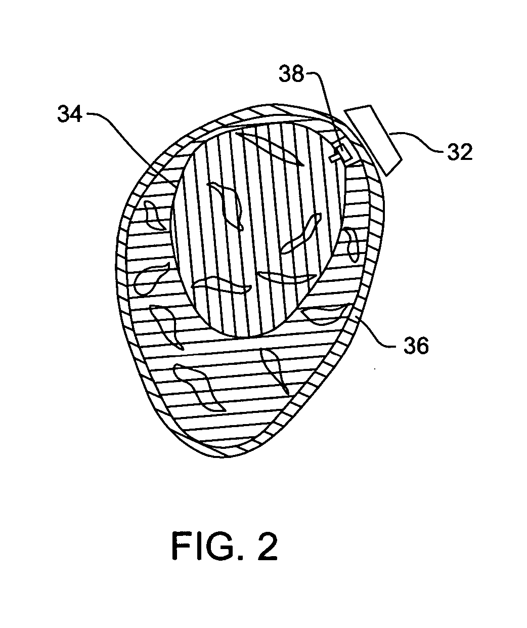 Hybrid navigation system for tracking the position of body tissue