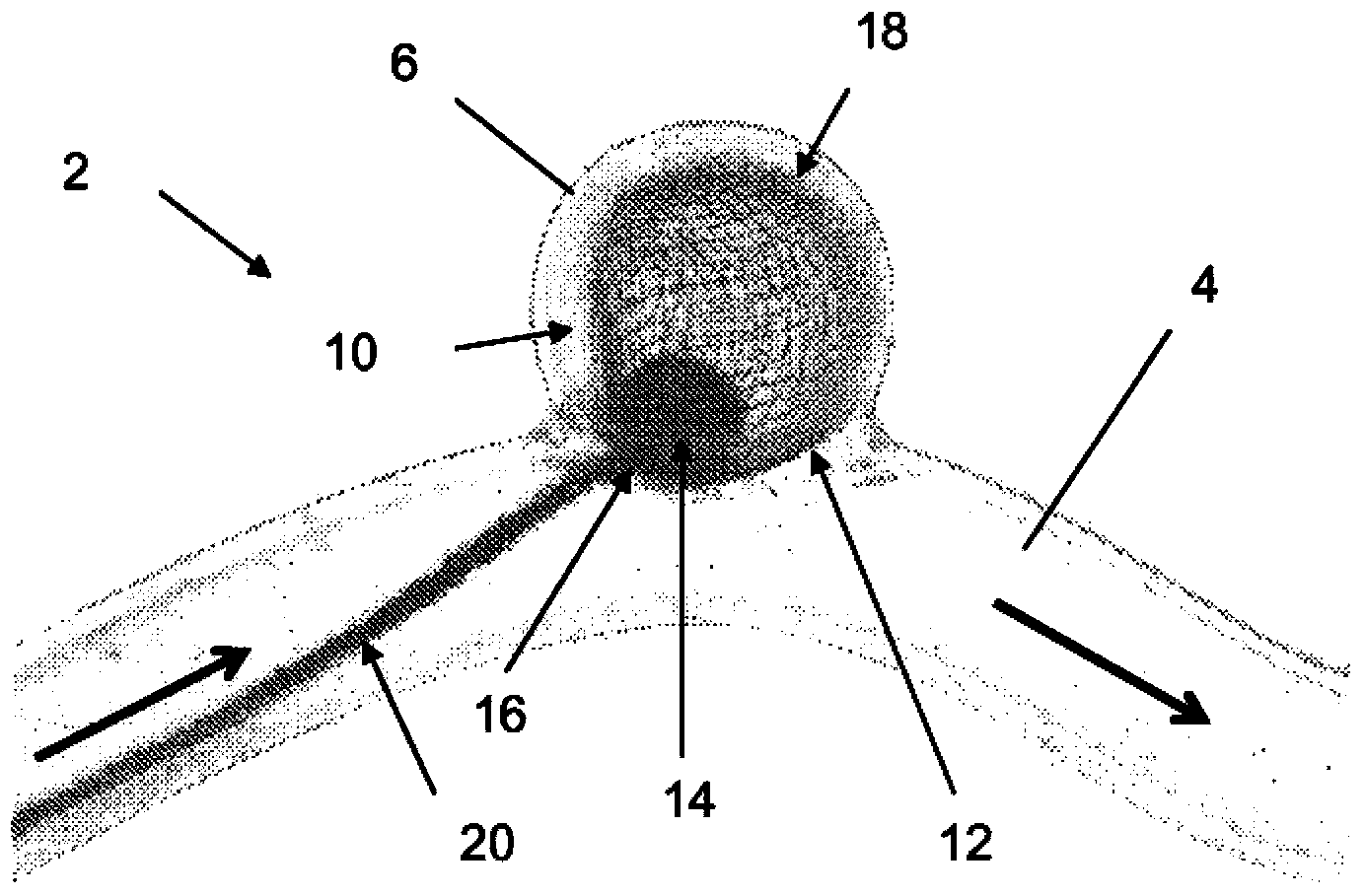 Two-stage deployment aneurysm embolization devices