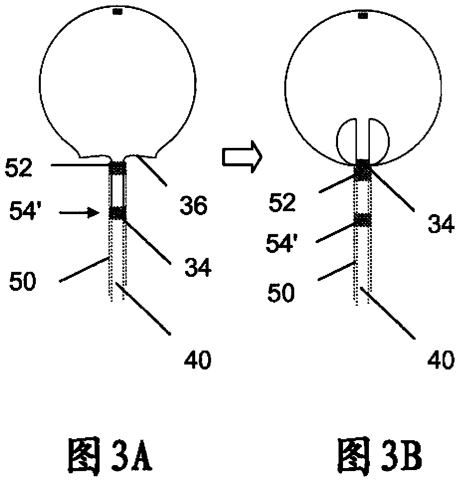 Two-stage deployment aneurysm embolization devices