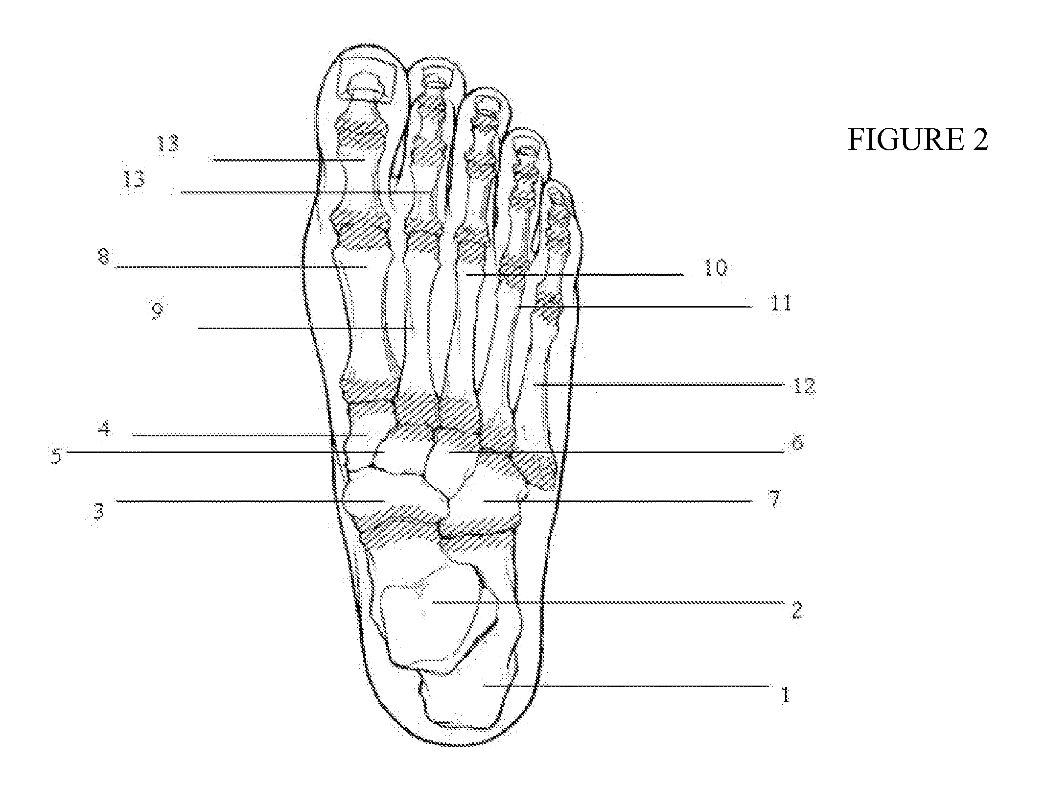 Orthotic insole assembly