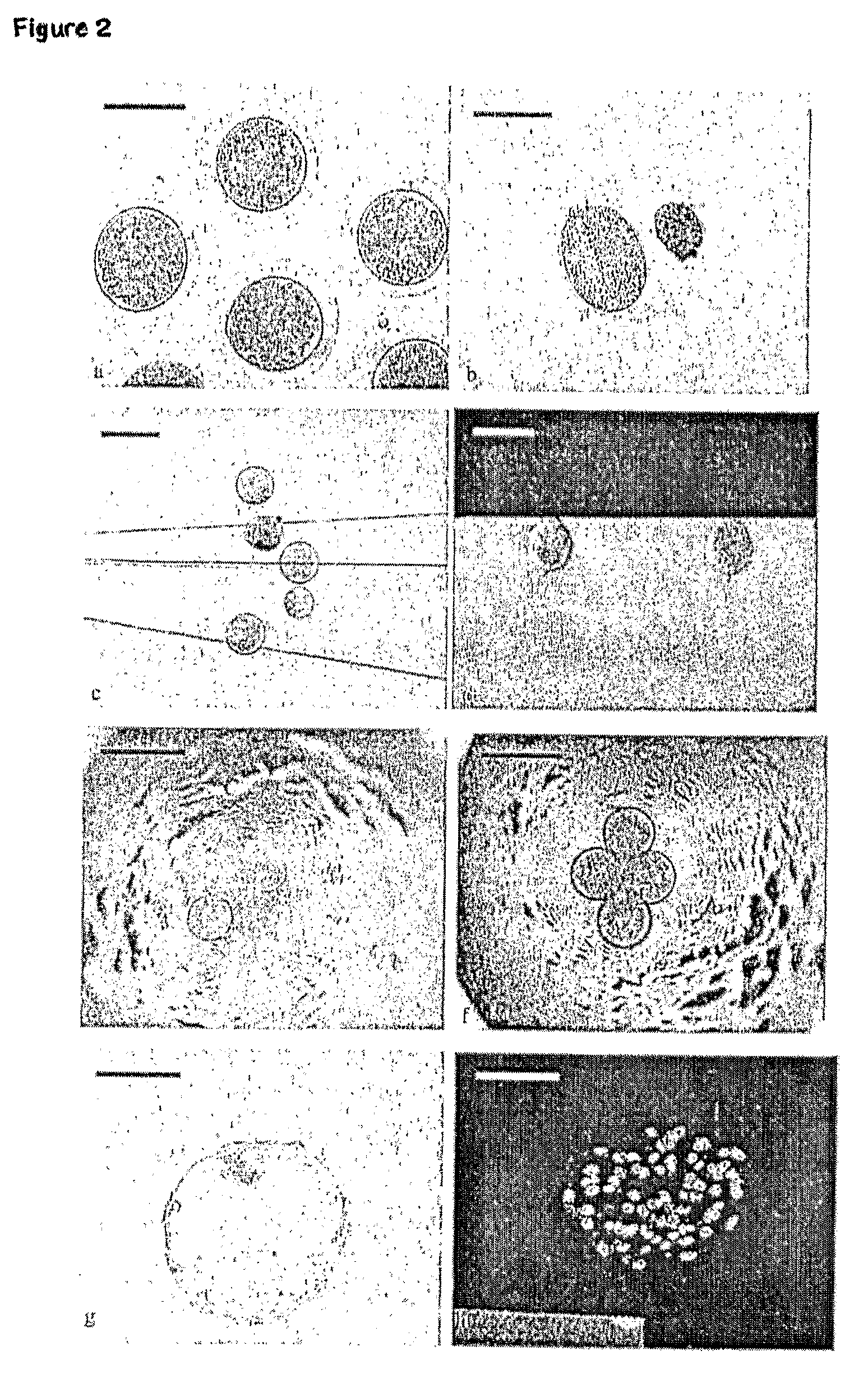 Cell nuclear transfer