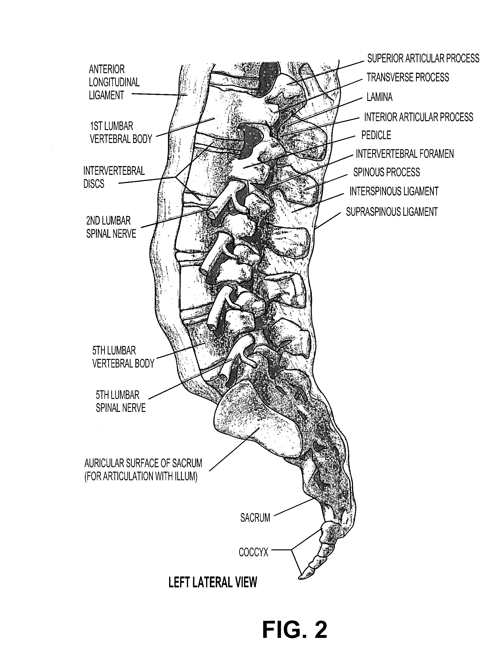 Surgical probe and method of making