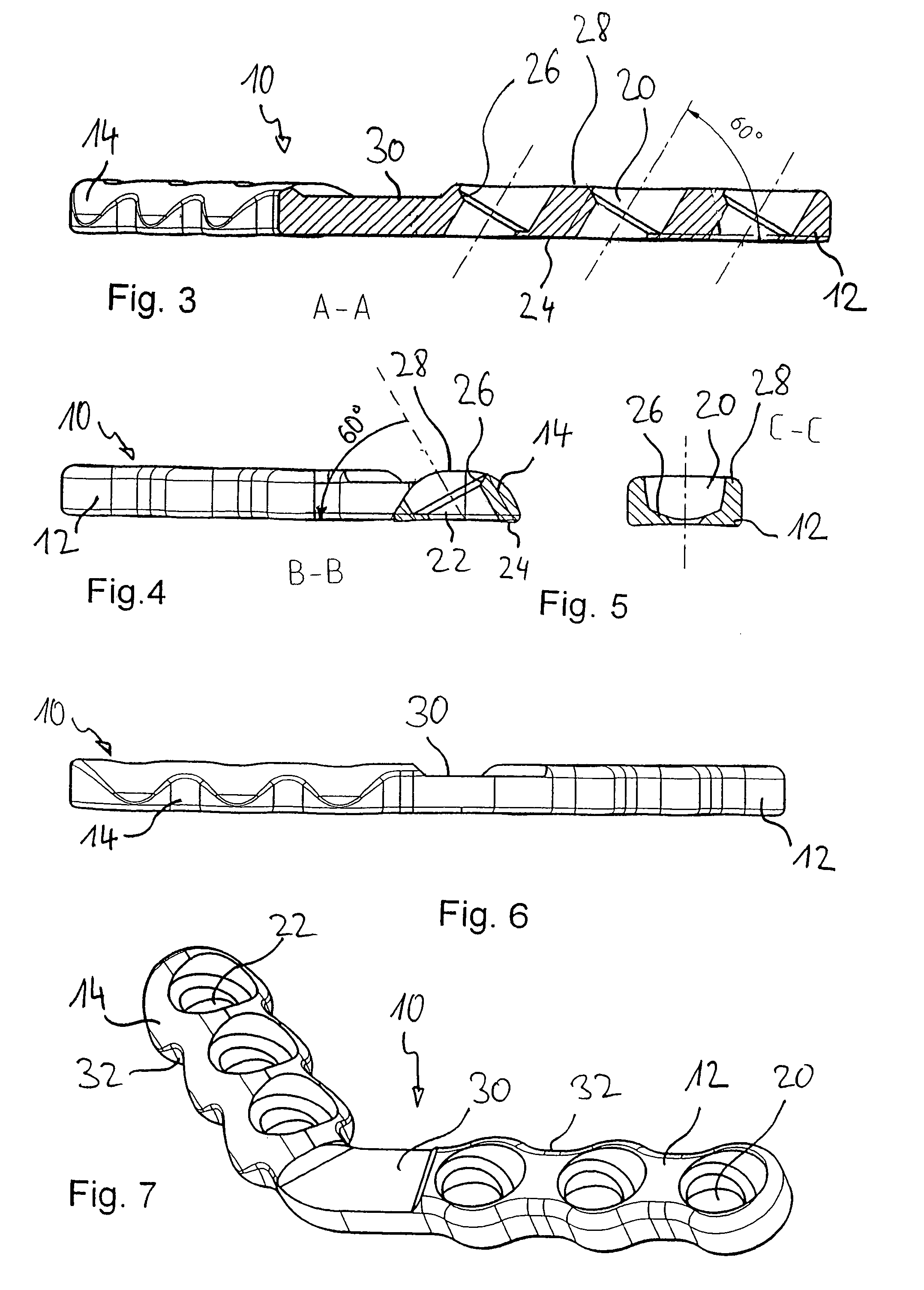 Osteosynthesis plate comprising through-openings which are inclined in relation to the plane of the plate