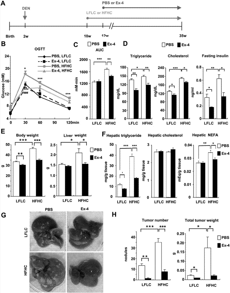 Drug for treating hepatocellular carcinoma and application of glucagon-like peptide-1 receptor stimulant and/or dipeptidyl peptidase 4 inhibitor