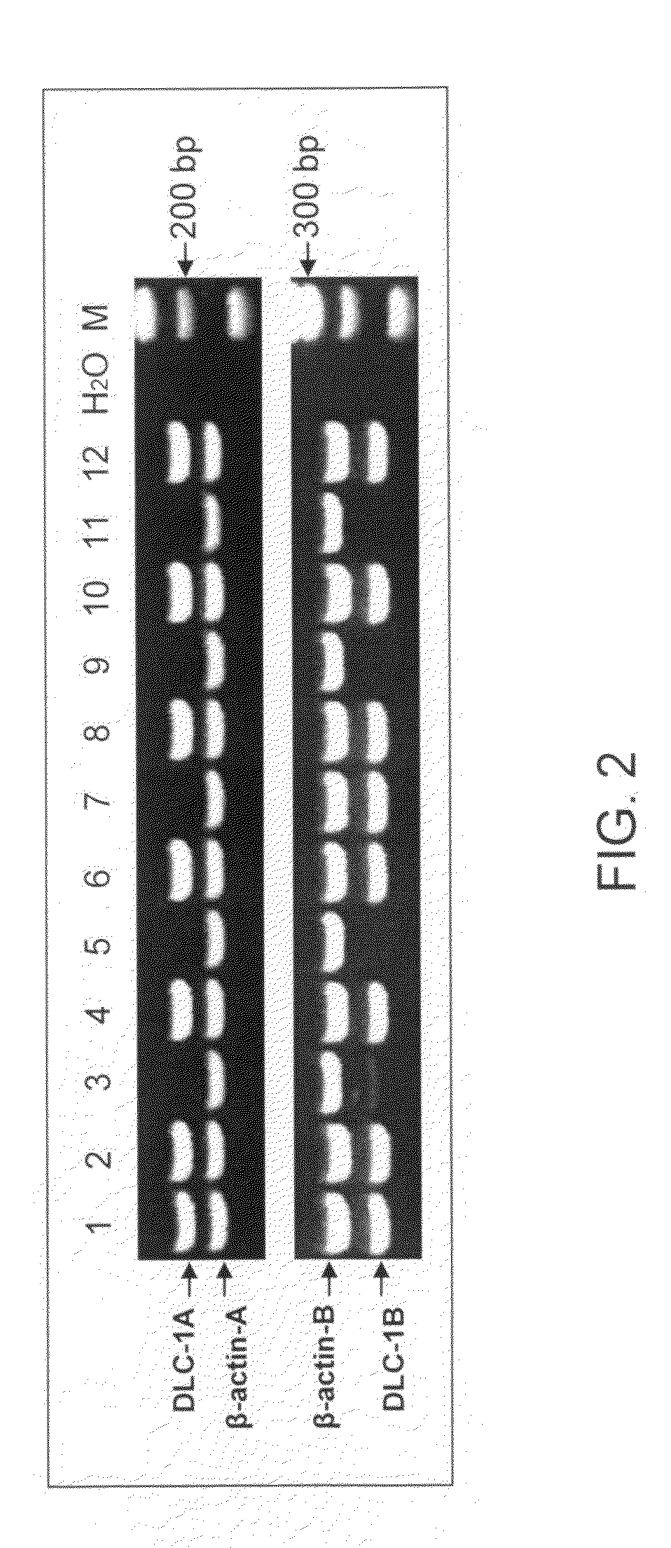 Method for detecting DNA methylation in cancer cells