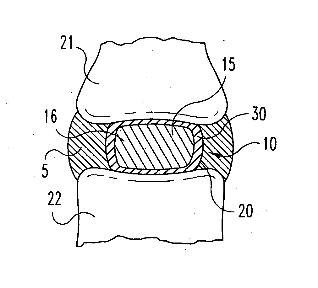 Intervertebral disc nucleus implants and methods