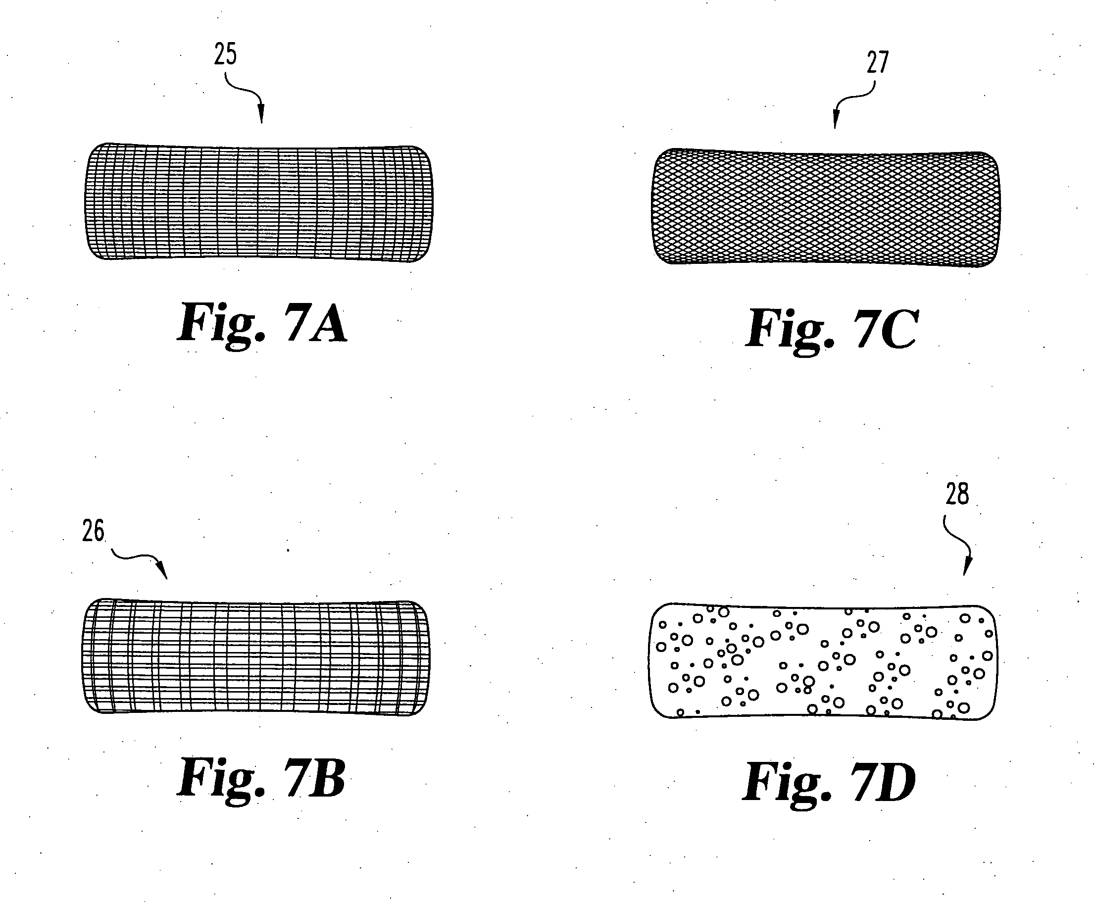 Intervertebral disc nucleus implants and methods