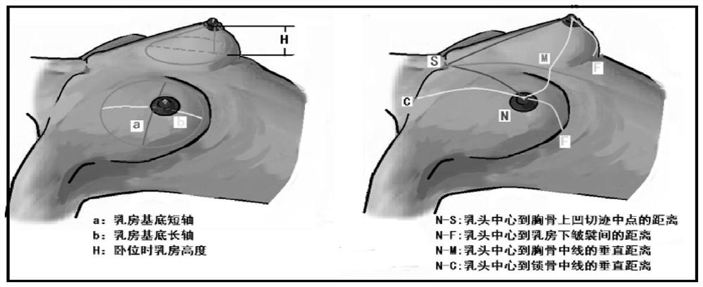 Method and device for accurately constructing breast visualization model based on CT image omics and evaluation method