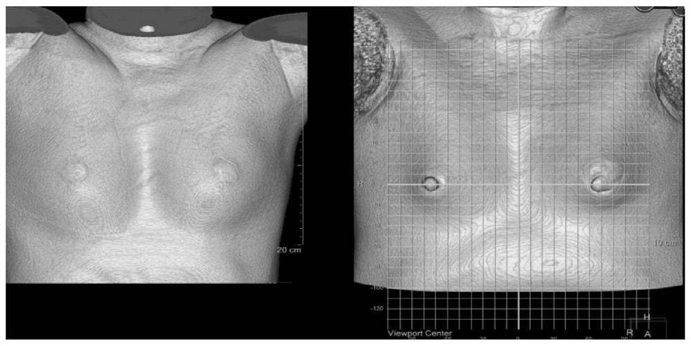 Method and device for accurately constructing breast visualization model based on CT image omics and evaluation method