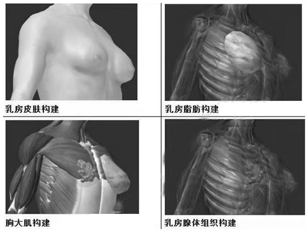 Method and device for accurately constructing breast visualization model based on CT image omics and evaluation method