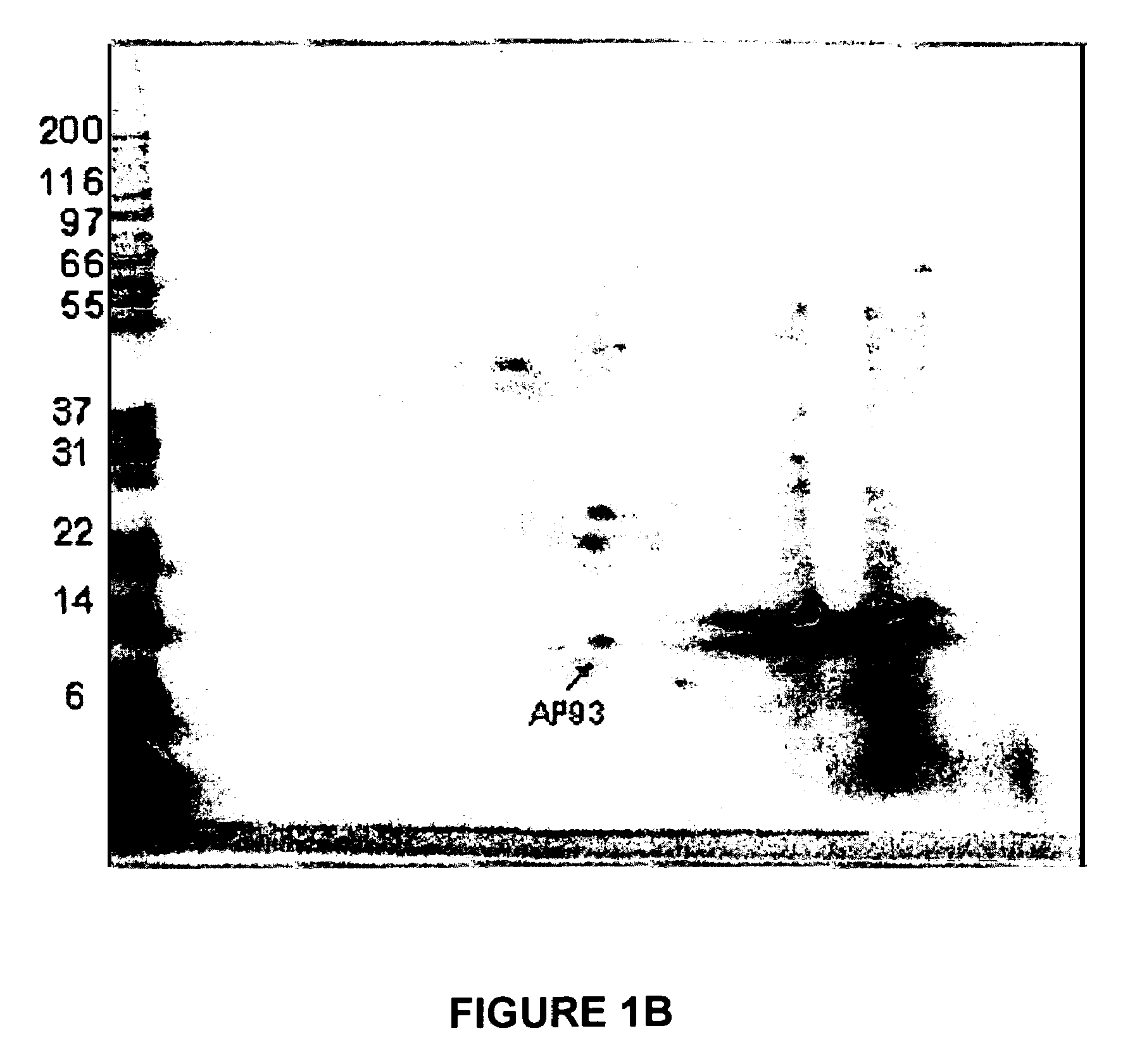 Methods and devices for diagnosis of appendicitis