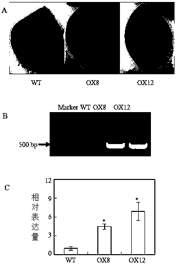 Gene GmSPX5 for regulating and controlling growth of leguminosae root nodules, and application of gene GmSPX5