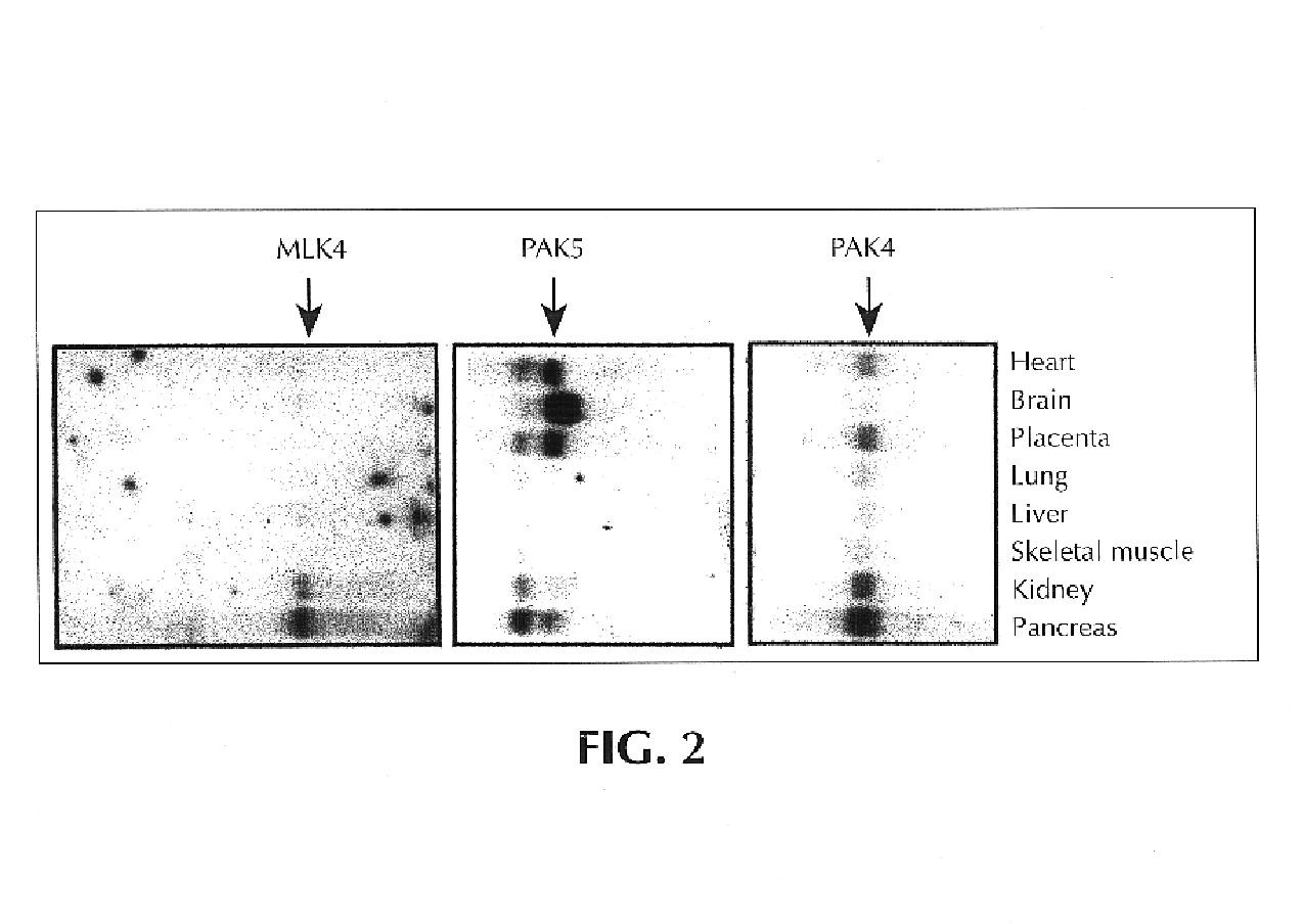 Genes and polynucleotides associated with ultraviolet radiation-mediated skin damage and uses thereof