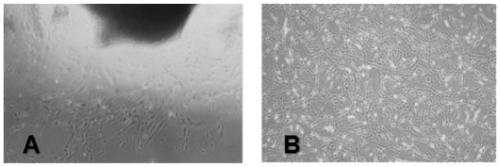 Induction composition of human mesenchymal stem cells, induction differentiation culture liquid and in-vitro induction method and application