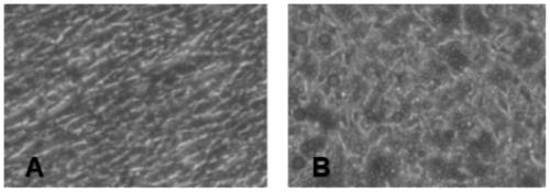 Induction composition of human mesenchymal stem cells, induction differentiation culture liquid and in-vitro induction method and application