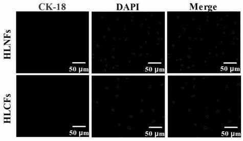 Establishment method of novel hepatic fibroblast strain